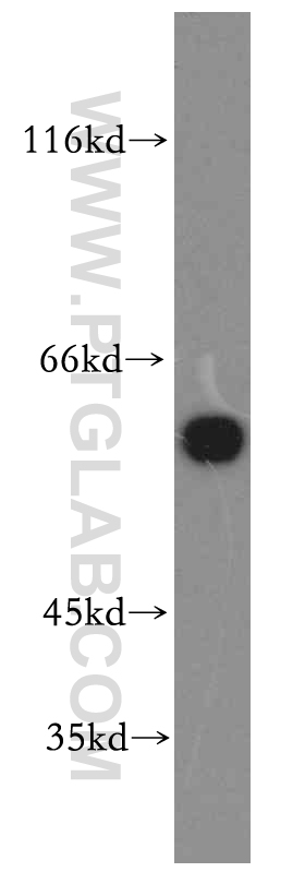 Catalase-Specific Polyclonal antibody