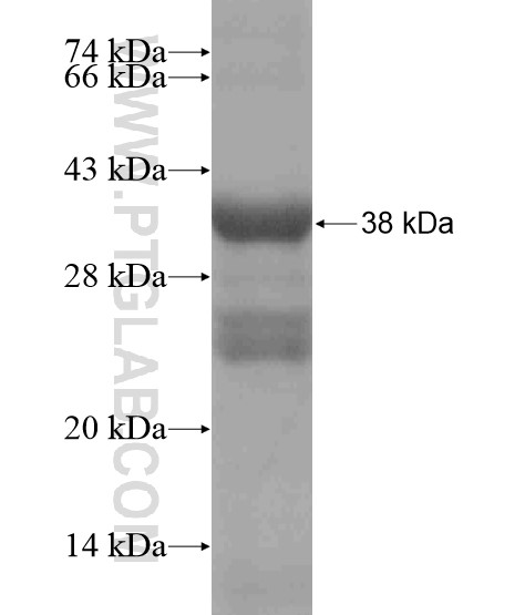 CATSPER4 fusion protein Ag19170 SDS-PAGE CATSPER4 fusion protein Ag19170 SDS-PAGE