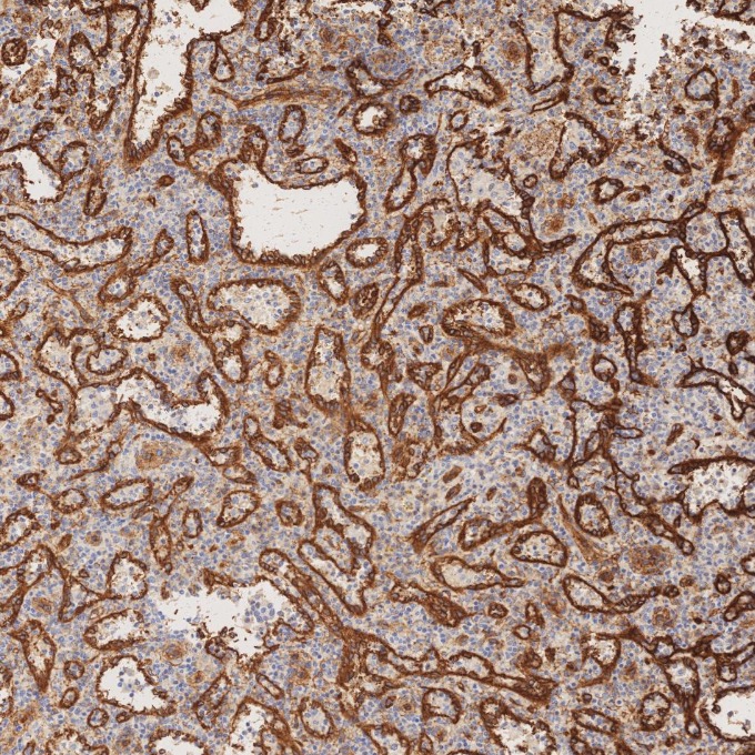 IHC staining of human spleen using 66067-1-Ig