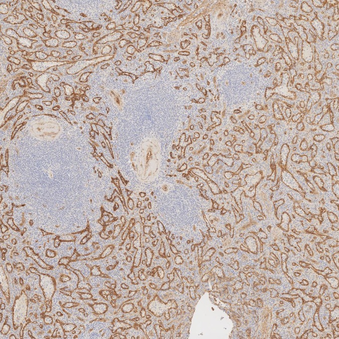 IHC staining of human spleen using 66067-1-Ig