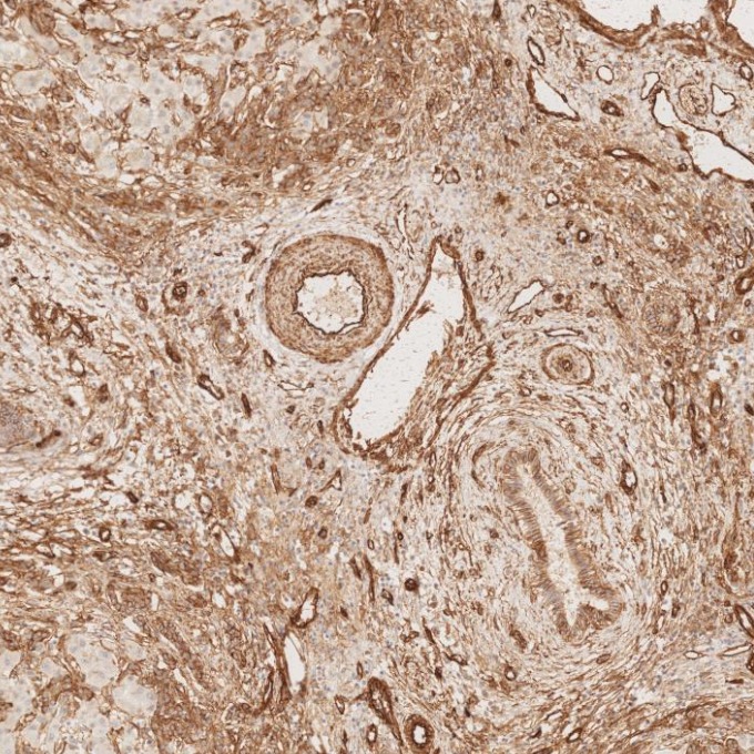 IHC staining of human liver using 66067-1-Ig