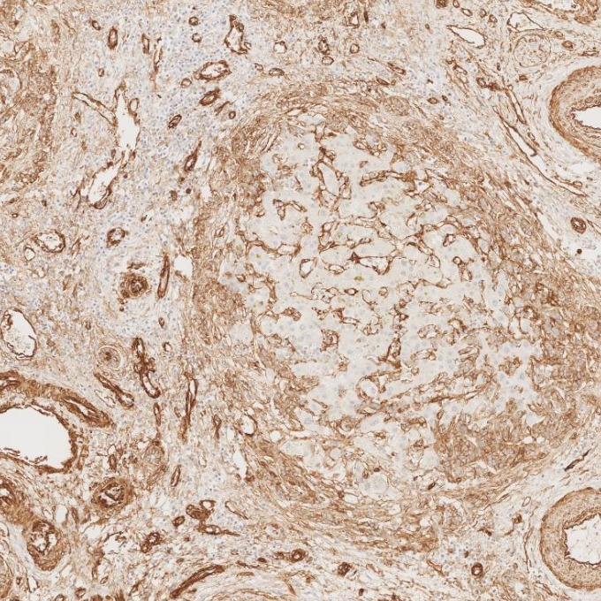 IHC staining of human liver using 66067-1-Ig