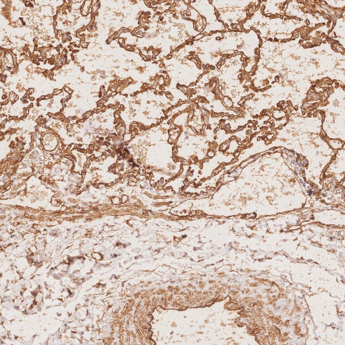IHC staining of human lung using 66067-1-Ig