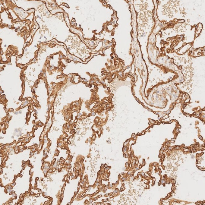 IHC staining of human lung using 66067-1-Ig
