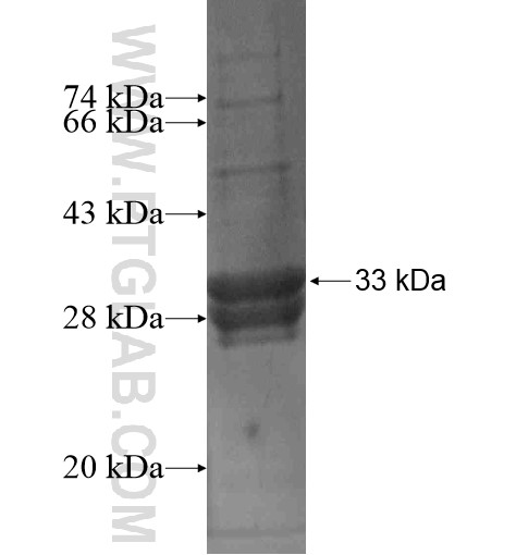 CAV1 fusion protein Ag10924 SDS-PAGE CAV1 fusion protein Ag10924 SDS-PAGE