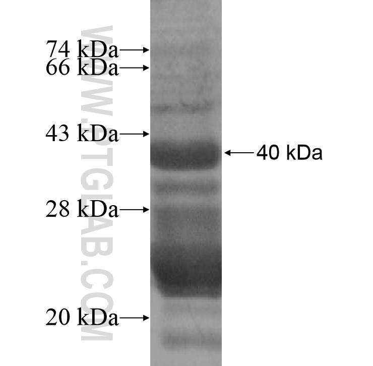 CAV1 fusion protein Ag11052 SDS-PAGE