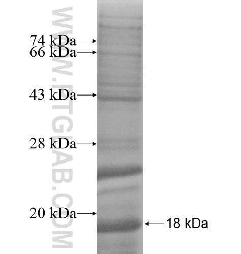 CAV1 fusion protein Ag11463 SDS-PAGE CAV1 fusion protein Ag11463 SDS-PAGE