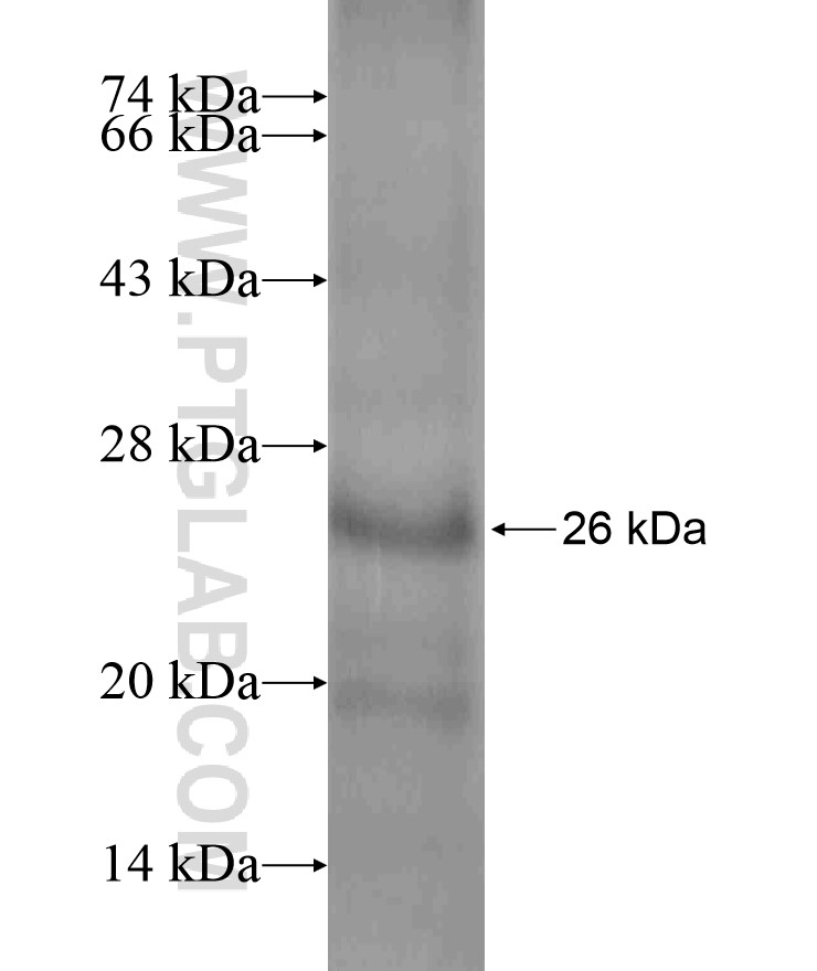CAV2 fusion protein Ag16902 SDS-PAGE CAV2 fusion protein Ag16902 SDS-PAGE