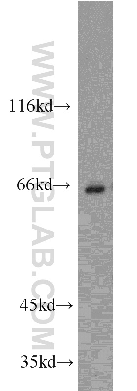 WB analysis of Jurkat using 17190-1-AP