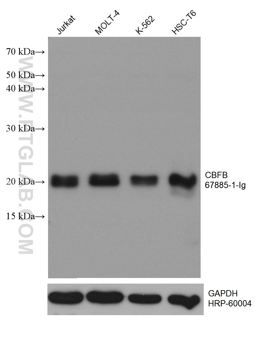 WB analysis using 67885-1-Ig