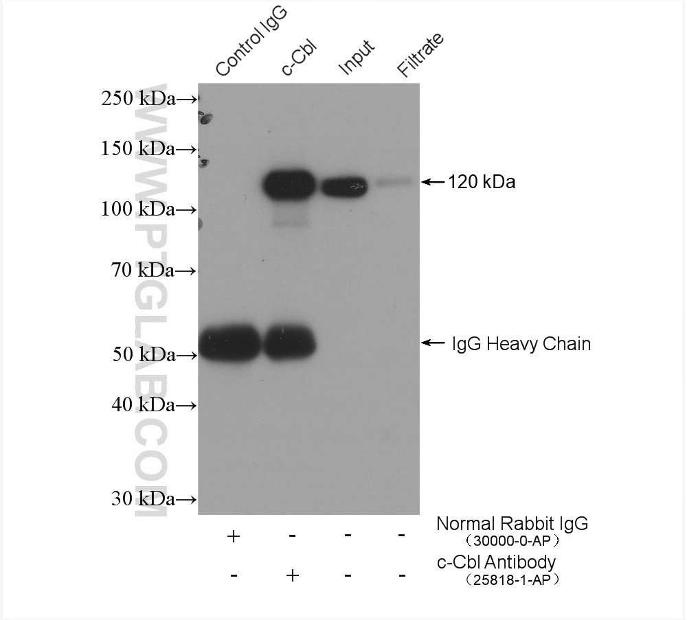 IP experiment of K-562 using 25818-1-AP