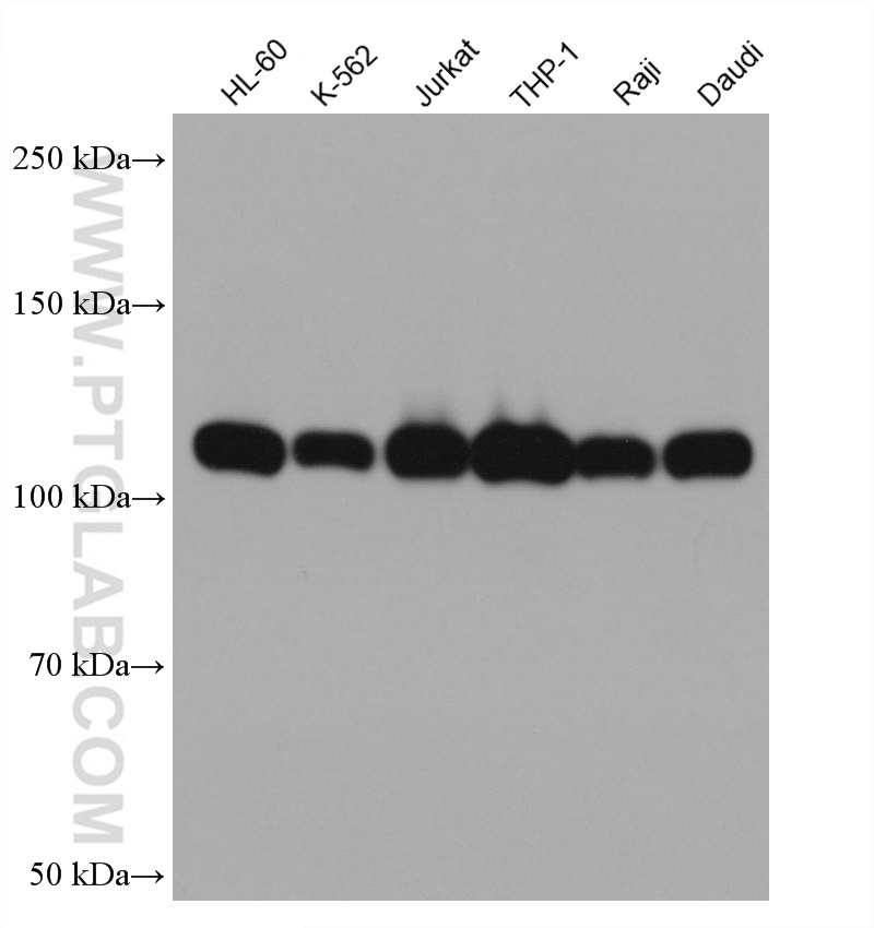 WB analysis using 66576-1-Ig (same clone as 66576-1-PBS)