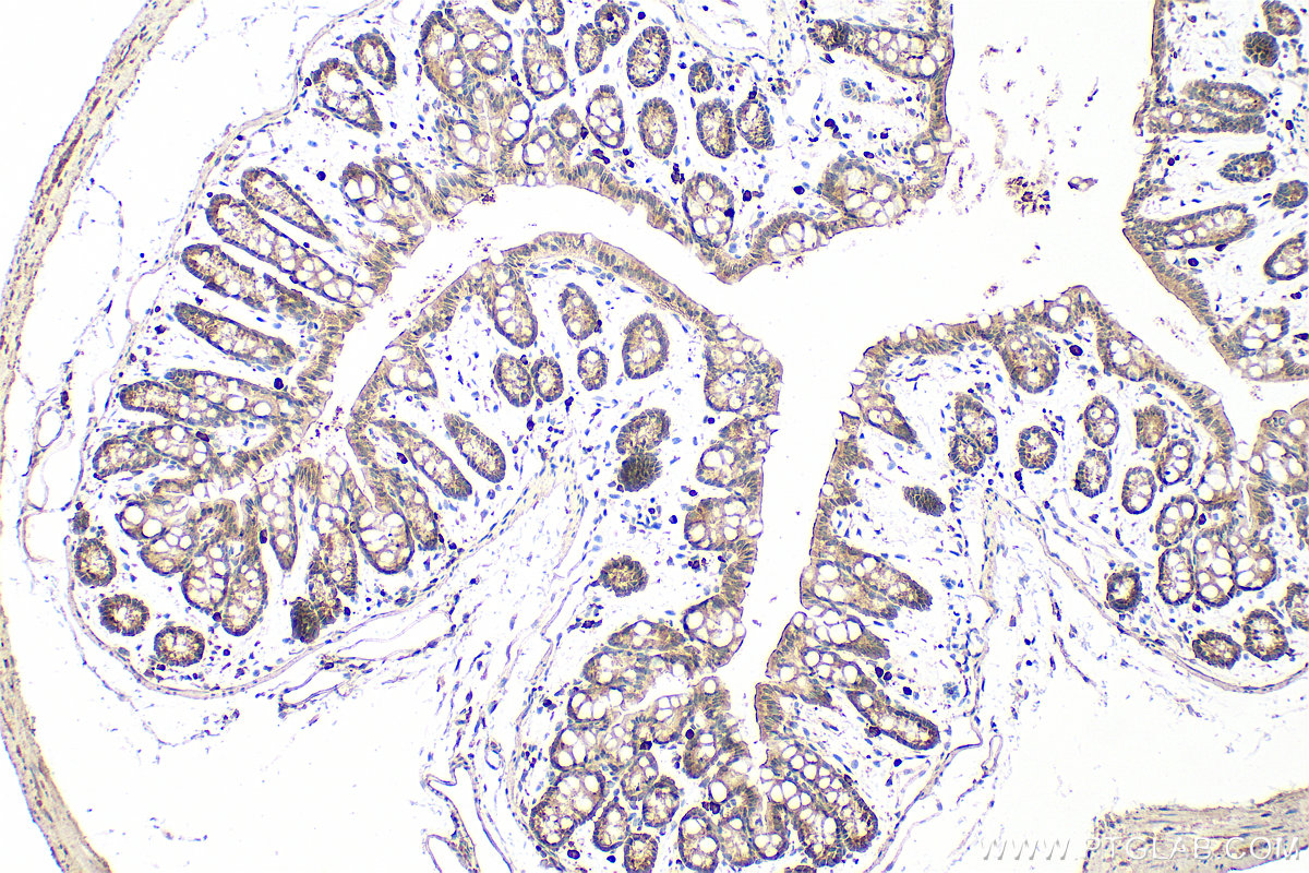 IHC staining of mouse colon using 12781-1-AP