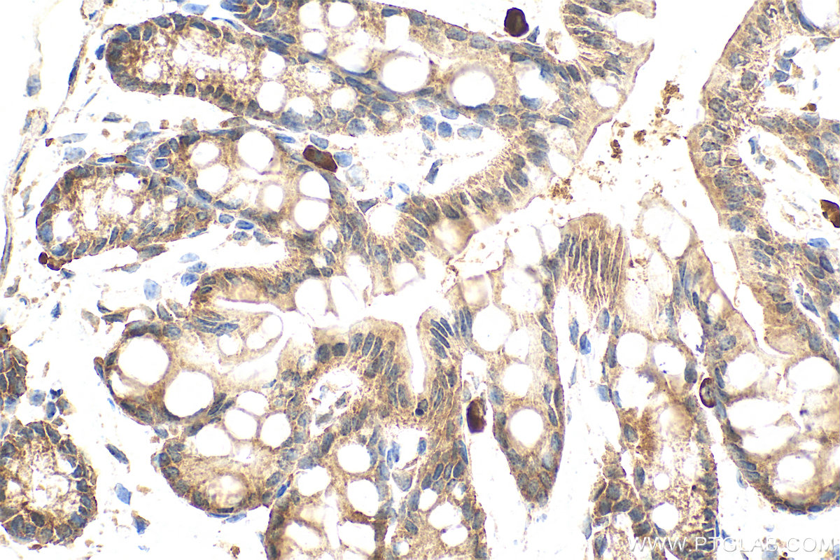 IHC staining of mouse colon using 12781-1-AP