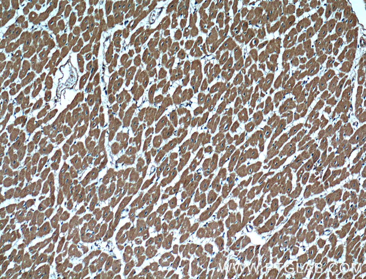 IHC staining of human heart using 66353-1-Ig