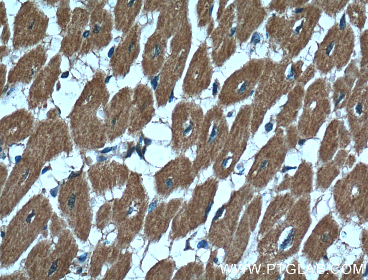 IHC staining of human heart using 66353-1-Ig