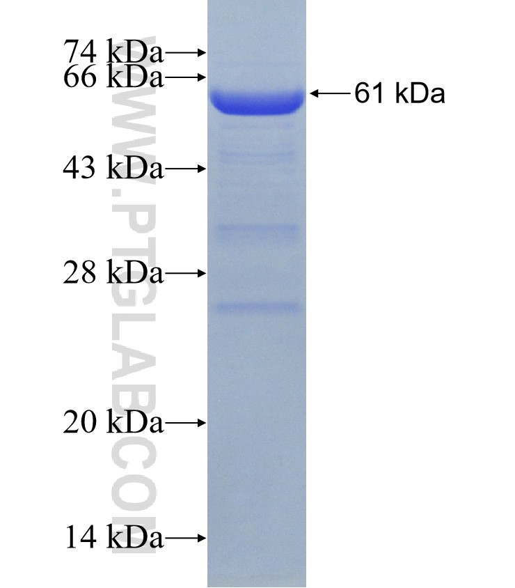 CBLB fusion protein Ag31210 SDS-PAGE CBLB fusion protein Ag31210 SDS-PAGE