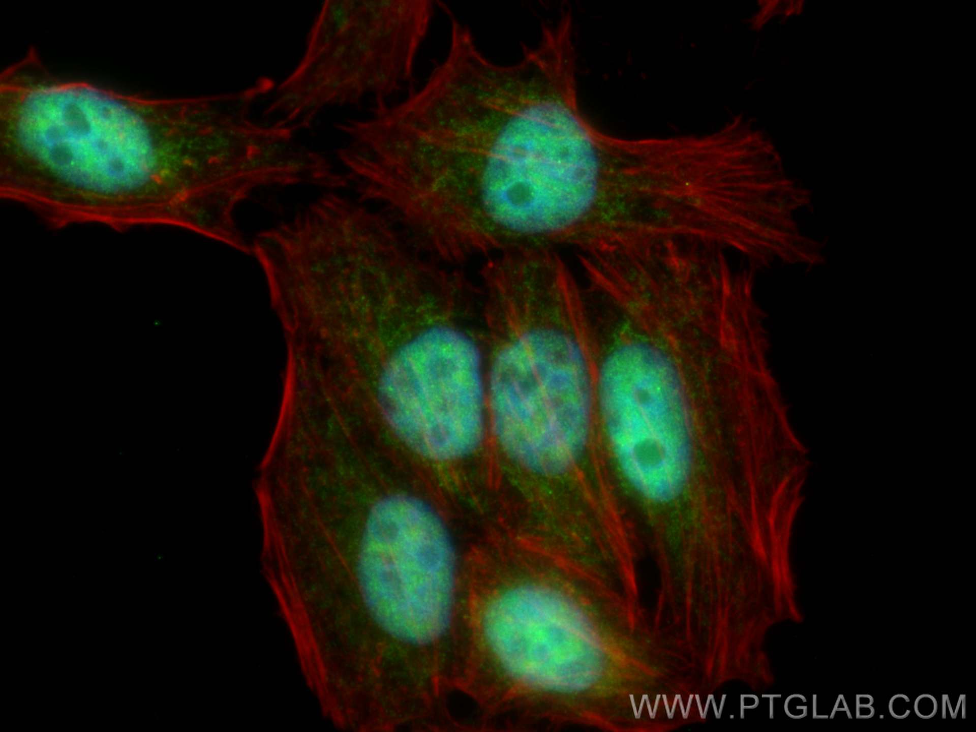 IF Staining of HepG2 using 21179-1-AP