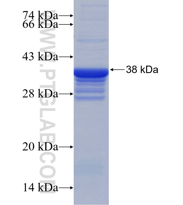 CBLL1 fusion protein Ag30900 SDS-PAGE
