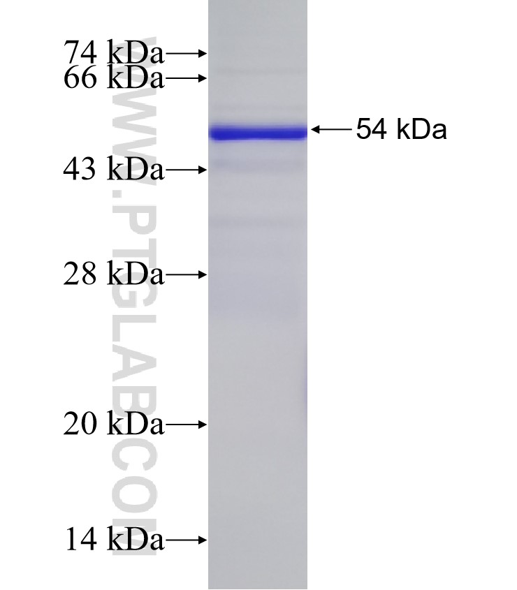 CBLL1 fusion protein Ag33328 SDS-PAGE CBLL1 fusion protein Ag33328 SDS-PAGE