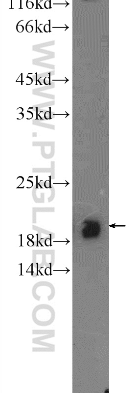 WB analysis of mouse cerebellum using 20559-1-AP