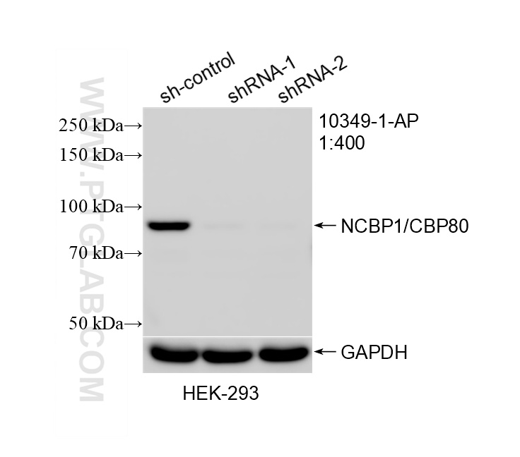 WB result of NCBP1/CBP80 antibody (10349-1-AP; 1:400; incubated at room temperature for 1.5 hours) with sh-Control and sh-NCBP1/CBP80 transfected HEK-293 cells. WB analysis of HEK-293 using 10349-1-AP