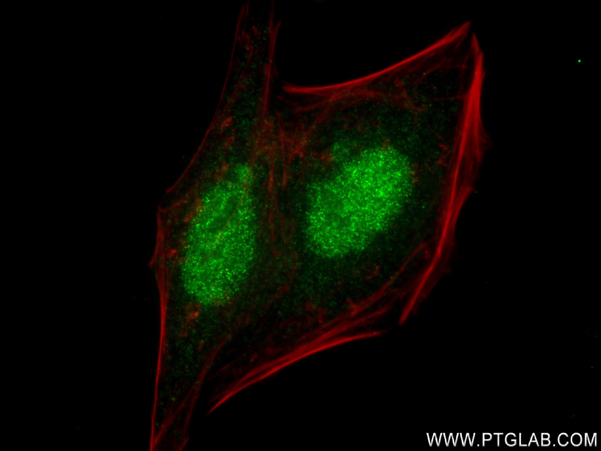 IF Staining of HepG2 using 83212-4-RR (same clone as 83212-4-PBS)