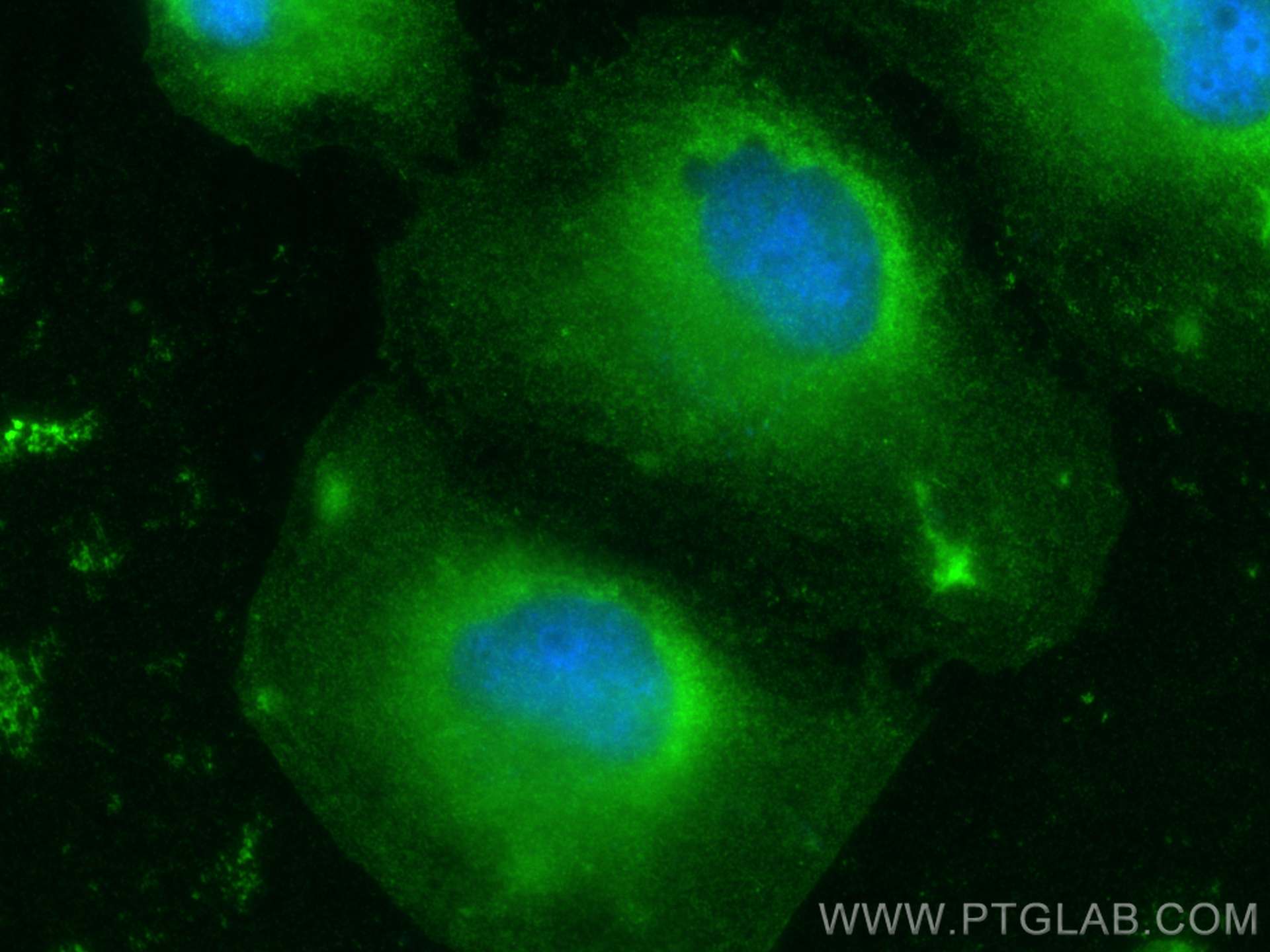 IF Staining of HeLa using 31279-1-AP
