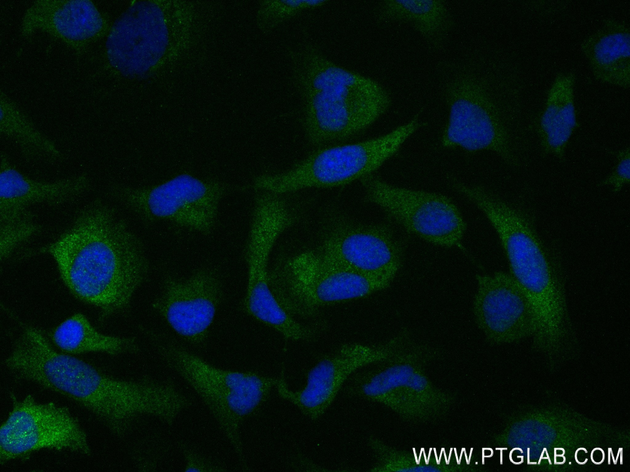 IF Staining of HeLa using 83736-4-RR (same clone as 83736-4-PBS)