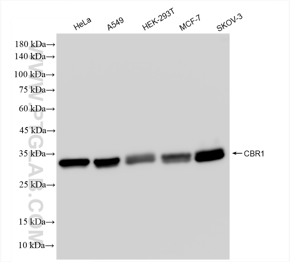 WB analysis using 83736-4-RR (same clone as 83736-4-PBS)