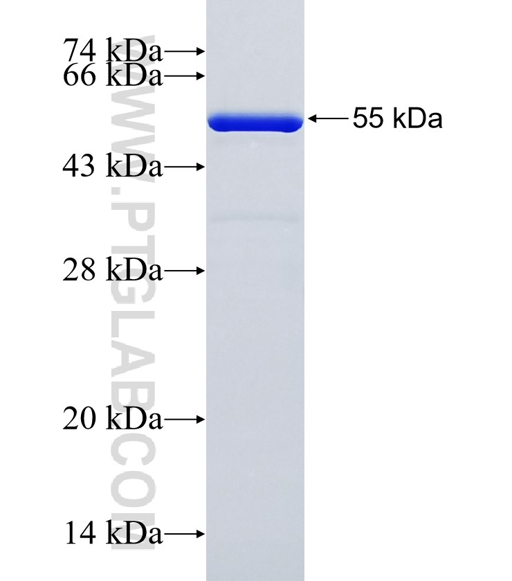 CBR1 fusion protein Ag34830 SDS-PAGE
