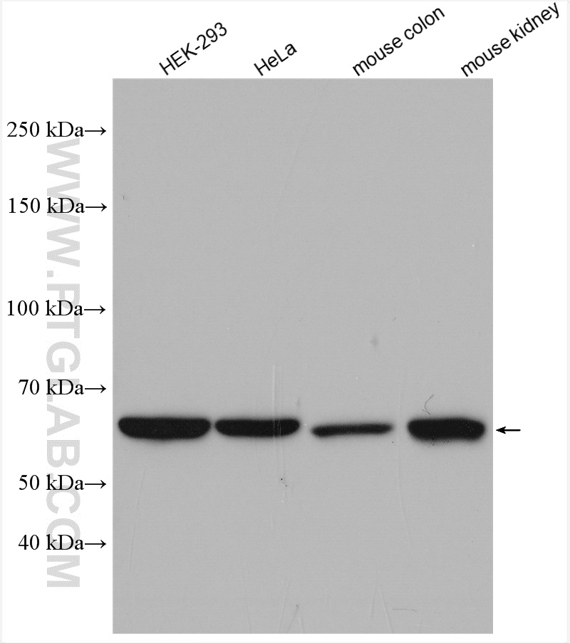 WB analysis using 14787-1-AP