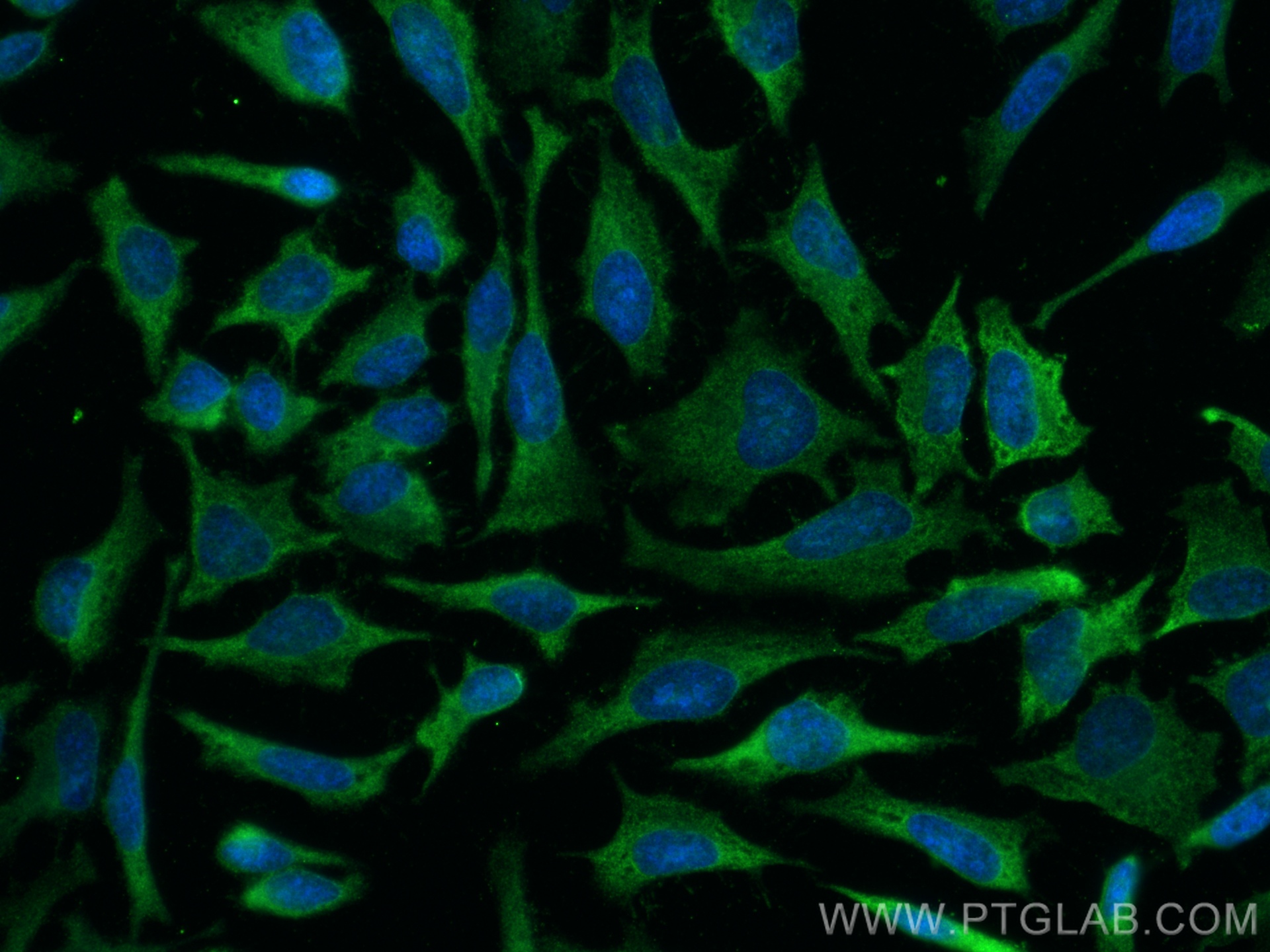 IF Staining of HeLa using 67861-1-Ig (same clone as 67861-1-PBS)