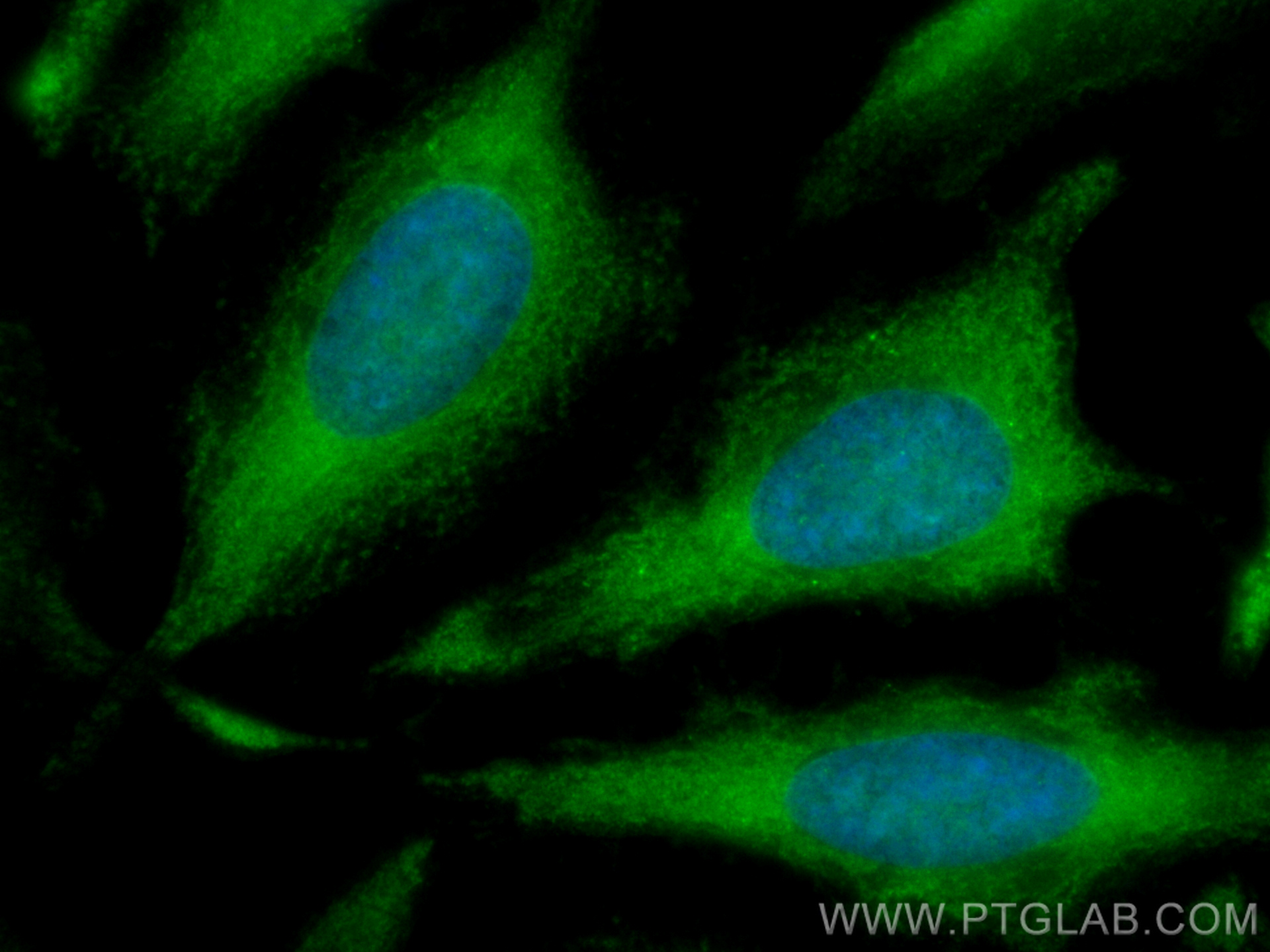 IF Staining of HeLa using CL488-14787