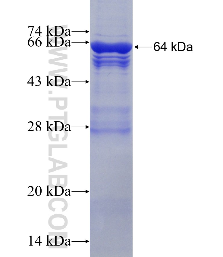 CBS fusion protein Ag6437 SDS-PAGE