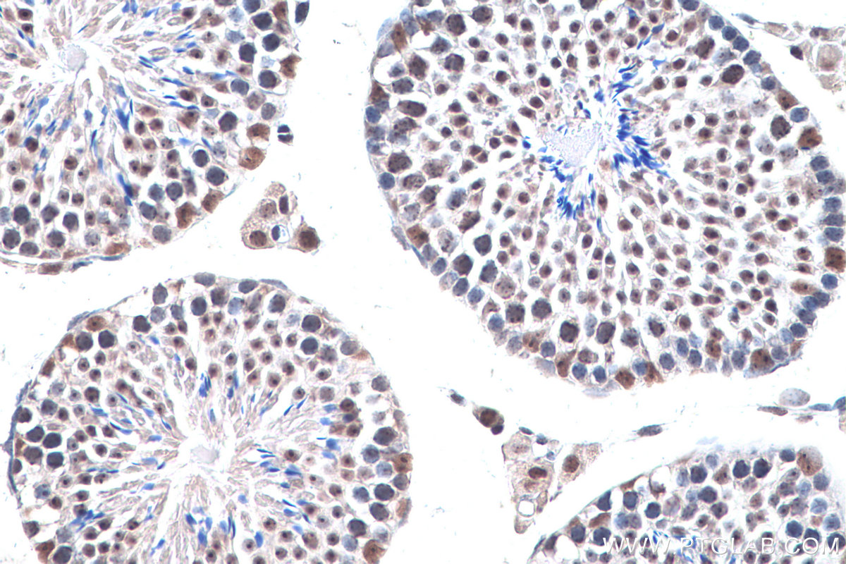 IHC staining of mouse testis using 10241-2-AP