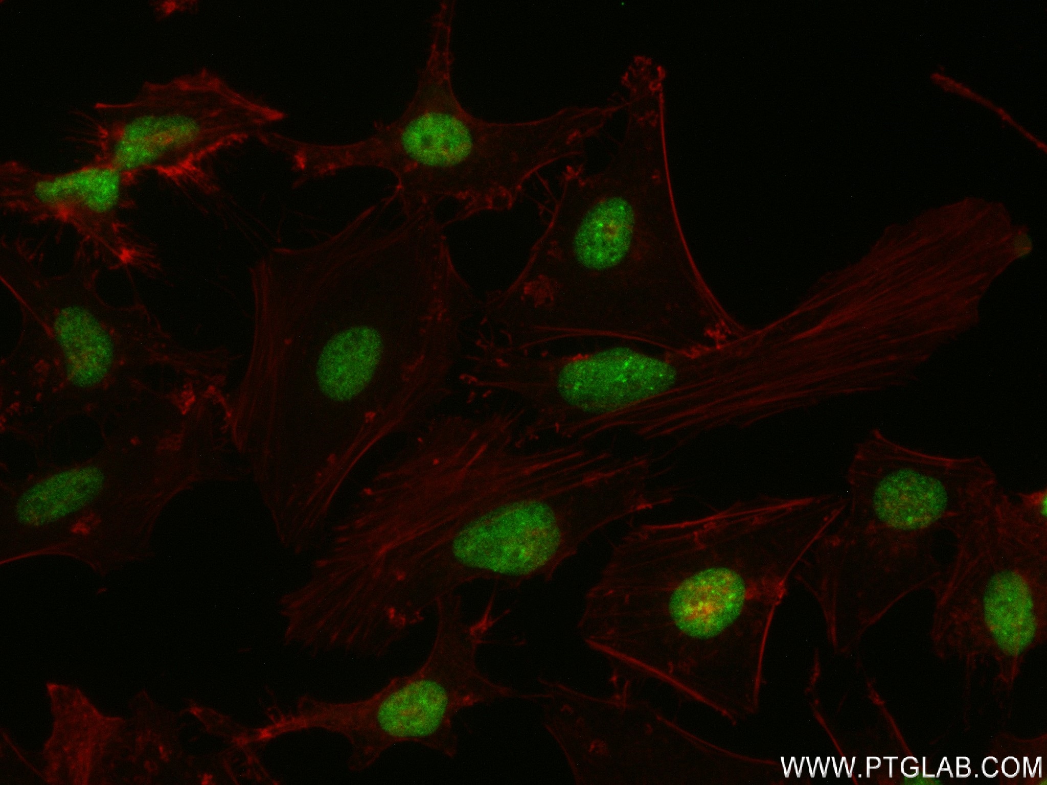 IF Staining of HeLa using 83248-3-RR