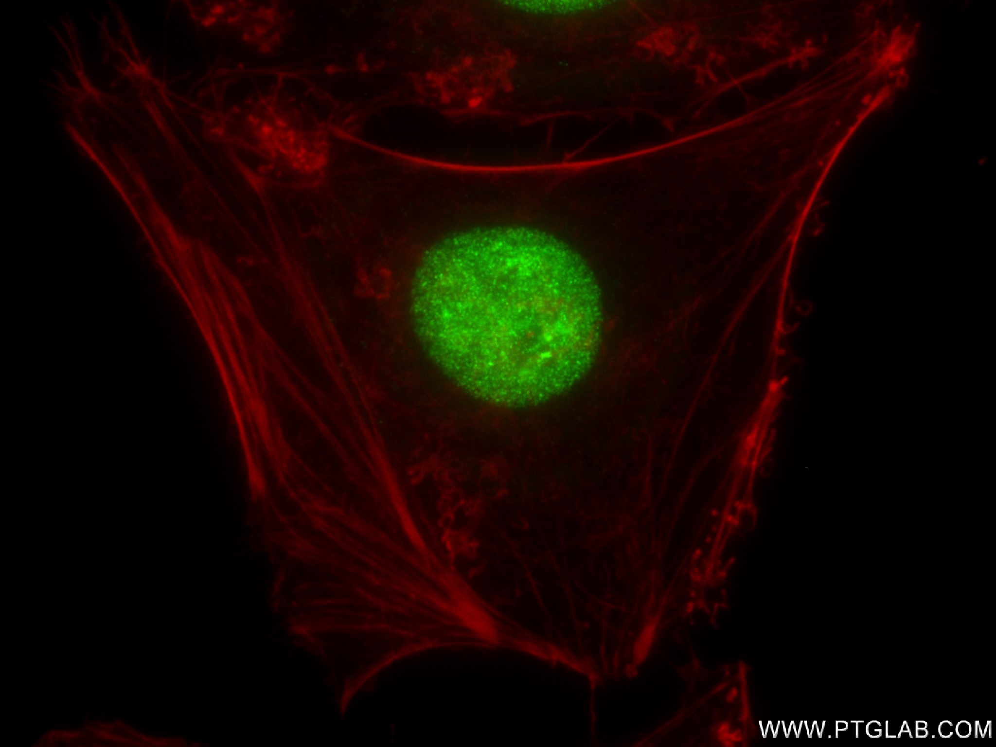 IF Staining of HeLa using 83248-3-RR
