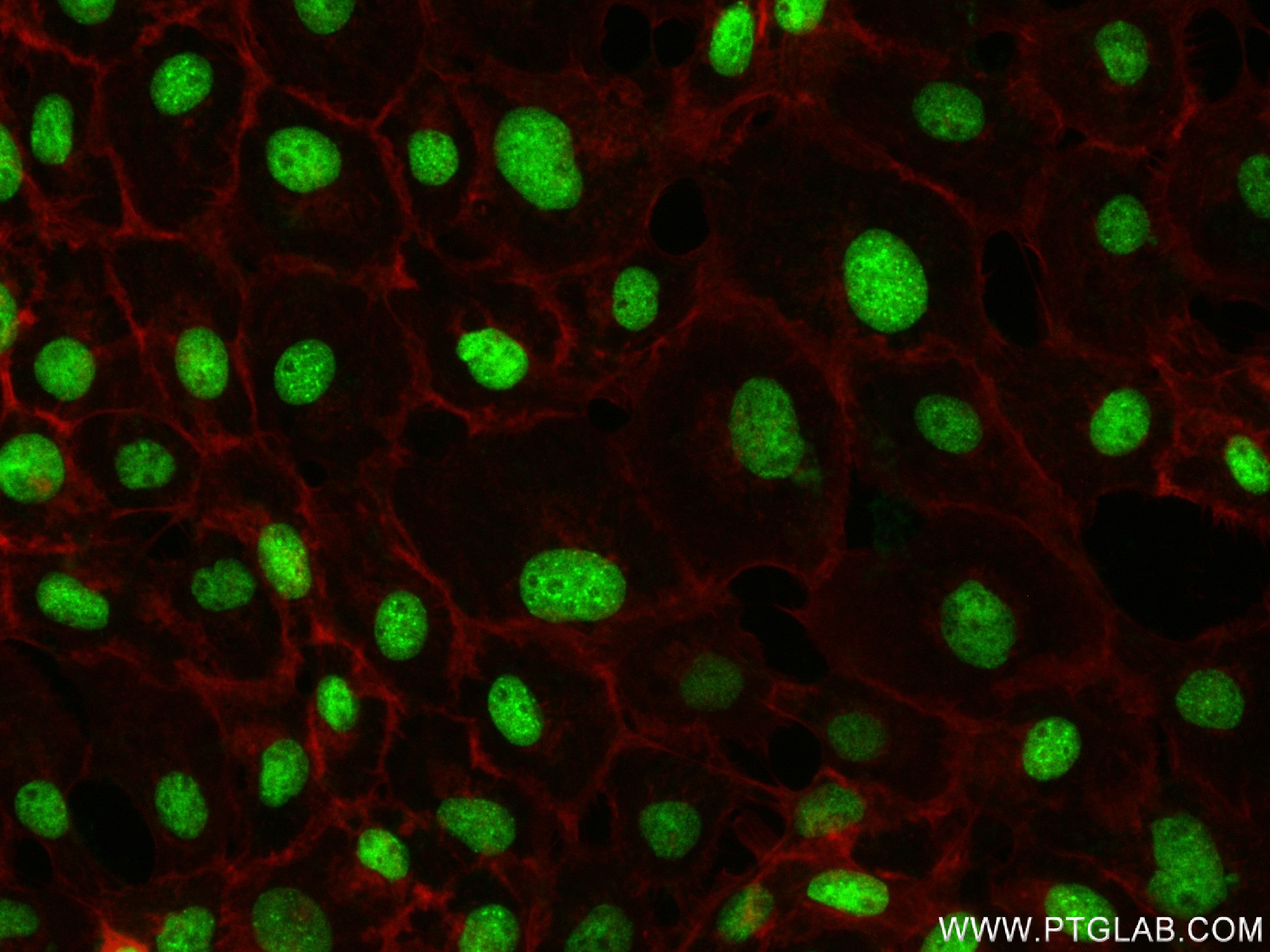 IF Staining of A431 using 83248-3-RR