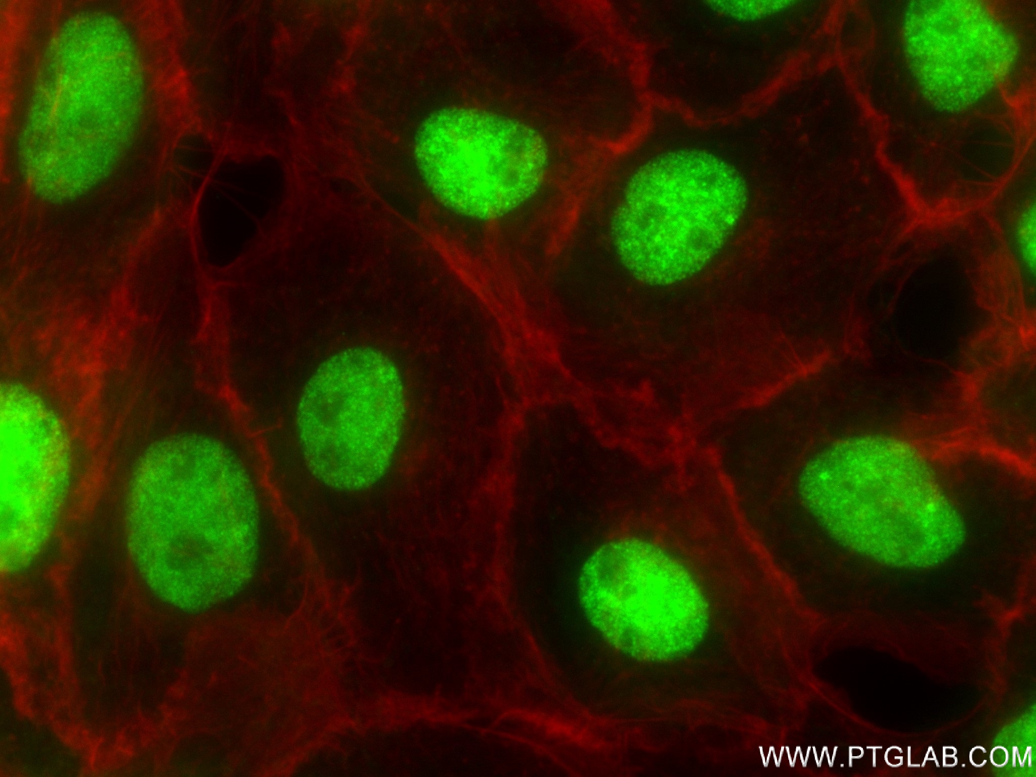 IF Staining of A431 using 83248-3-RR