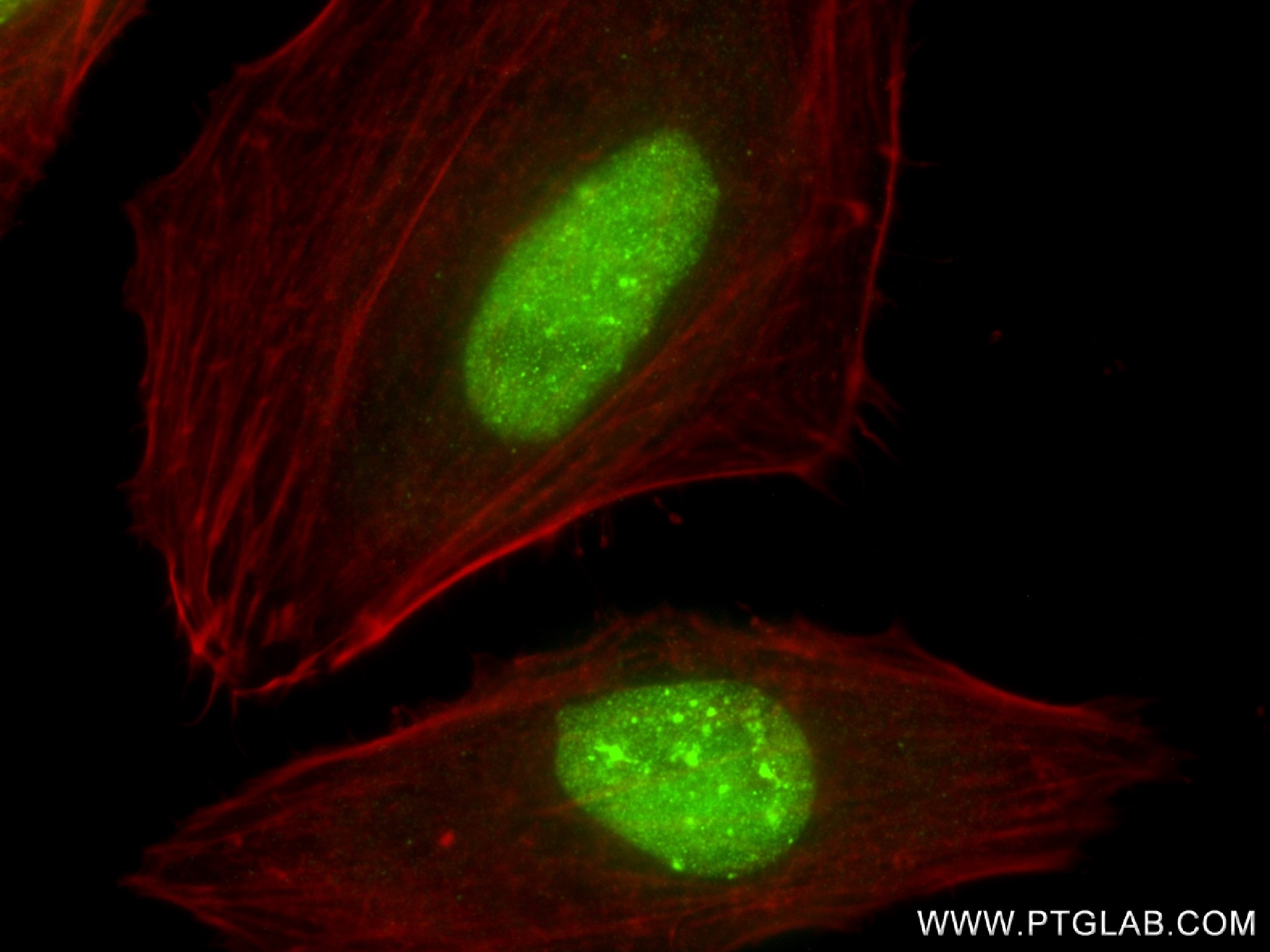 IF Staining of HeLa using 83248-4-RR
