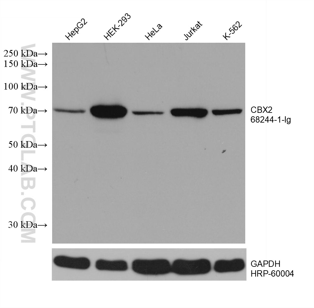 CBX2