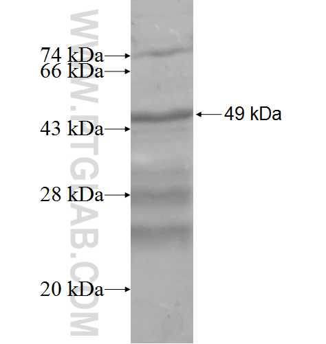 CBX2 fusion protein Ag7979 SDS-PAGE