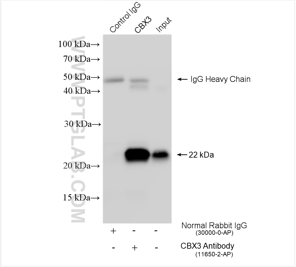 IP experiment of mouse spleen using 11650-2-AP