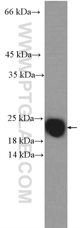 WB analysis of mouse spleen using 11650-2-AP