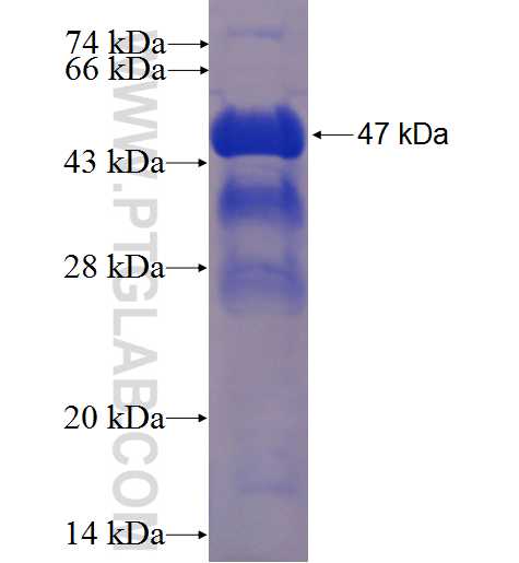 CBX3 fusion protein Ag2251 SDS-PAGE