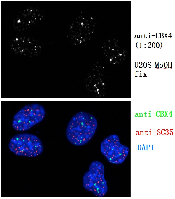 IF Staining of U2OS cell using 18544-1-AP