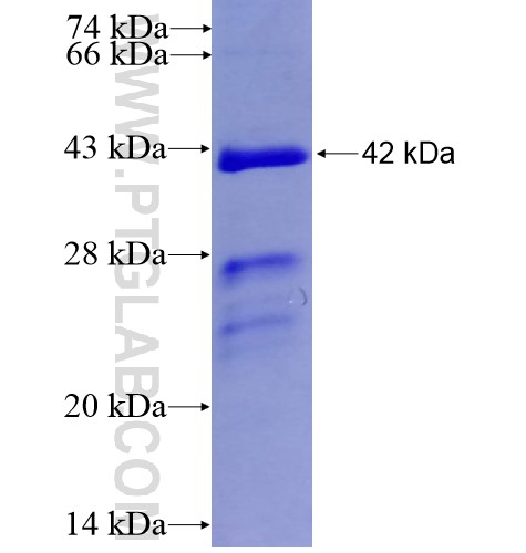 CBX4 fusion protein Ag13450 SDS-PAGE CBX4 fusion protein Ag13450 SDS-PAGE