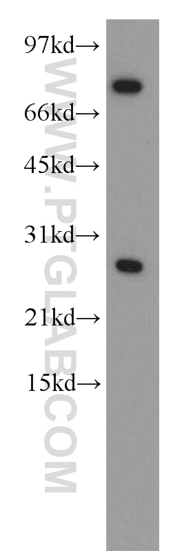 CBX5 Polyclonal antibody