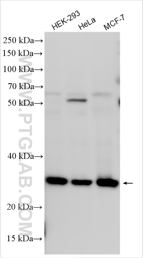 CBX5